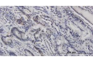 Immunohistochemistry (IHC) image for anti-Tumor Protein P53 (TP53) (pSer315) antibody (ABIN3201006)