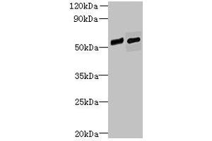 Western blot All lanes: FAM124B antibody at 12 μg/mL Lane 1: Hela whole cell lysate Lane 2: K562 whole cell lysate Secondary Goat polyclonal to rabbit IgG at 1/10000 dilution Predicted band size: 51, 32 kDa Observed band size: 51 kDa (FAM124B Antikörper  (AA 146-272))