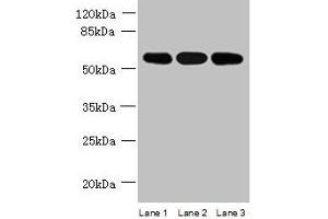 Western blot All lanes: STK33 antibody at 4 μg/mL Lane 1: Mouse kidney tissue Lane 2: Hela whole cell lysate Lane 3: Jurkat whole cell lysate Secondary Goat polyclonal to rabbit IgG at 1/10000 dilution Predicted band size: 58, 51 kDa Observed band size: 58 kDa (STK33 Antikörper  (AA 231-514))