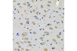 Immunohistochemistry of paraffin-embedded rat brain using TXNDC5 Antibody. (TXNDC5 Antikörper  (AA 1-324))