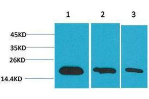 Western Blotting (WB) image for anti-Baculoviral IAP Repeat-Containing 5 (BIRC5) antibody (ABIN3181563) (Survivin Antikörper)