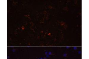 Immunofluorescence analysis of THP-1 cells using TLR4 Polyclonal Antibody at dilution of 1:100 (40x lens). (TLR4 Antikörper)