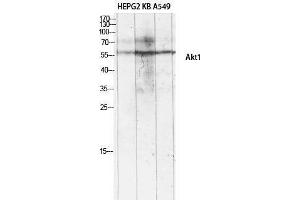 Western Blotting (WB) image for anti-V-Akt Murine Thymoma Viral Oncogene Homolog 1 (AKT1) (Ser134) antibody (ABIN3173743) (AKT1 Antikörper  (Ser134))