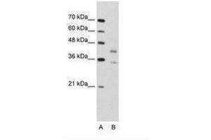 Image no. 1 for anti-DNA Fragmentation Factor, 45kDa, alpha Polypeptide (DFFA) (N-Term) antibody (ABIN203383) (DFFA Antikörper  (N-Term))