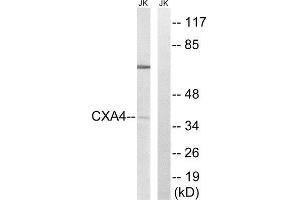 Western Blotting (WB) image for anti-Gap Junction Protein, alpha 4, 37kDa (GJA4) (Internal Region) antibody (ABIN1851364) (GJA4 Antikörper  (Internal Region))