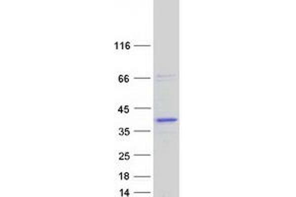 RDH13 Protein (Transcript Variant 1) (Myc-DYKDDDDK Tag)