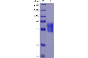Human PD-1 Protein, hFc-His Tag on SDS-PAGE under reducing condition. (PD-1 Protein (AA 25-167) (Fc-His Tag))