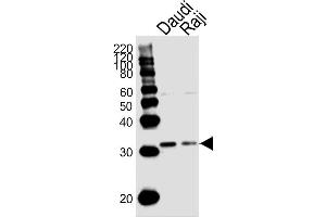 Lane 1: Daudi Cell lysates, Lane 2: Raji Cell lysates, probed with BCL10 (1185CT13. (BCL10 Antikörper)