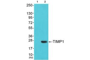 Western Blotting (WB) image for anti-TIMP Metallopeptidase Inhibitor 1 (TIMP1) (Internal Region) antibody (ABIN1848806) (TIMP1 Antikörper  (Internal Region))