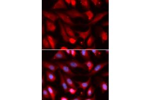 Immunofluorescence analysis of U2OS cells using SMAD4 antibody (ABIN5973302). (SMAD4 Antikörper)