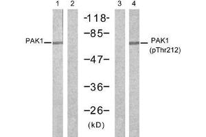 Western blot analysis of extracts from 293 cells, untreated or treated with forskolin (40µM, 30min), using PAK1 (Ab-212) antibody (E021160, Lane 1 and 2) and PAK1 (phospho-Thr212) antibody (E011154, Lane 3 and 4). (PAK1 Antikörper)