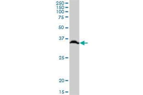 RPLP0 Antikörper  (AA 1-317)