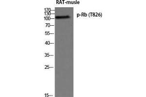 Western Blot (WB) analysis of Rat Muscle using p-Rb (T826) antibody. (Retinoblastoma 1 Antikörper  (pThr826))