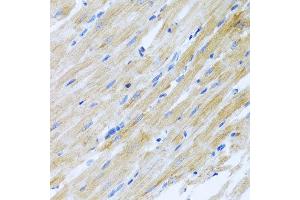 Immunohistochemistry of paraffin-embedded rat heart using CCL17 antibody at dilution of 1:100 (x40 lens). (CCL17 Antikörper)