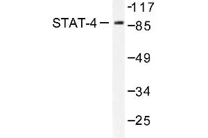 Image no. 2 for anti-Signal Transducer and Activator of Transcription 4 (STAT4) antibody (ABIN271914) (STAT4 Antikörper)