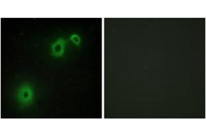 Immunofluorescence (IF) image for anti-Nerve Growth Factor Receptor (NGFR) (AA 121-170) antibody (ABIN2889383) (NGFR Antikörper  (AA 121-170))