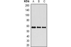 Western blot analysis of ALPP expression in HepG2 (A), rat testis (B), rat liver (C) whole cell lysates. (PLAP Antikörper)