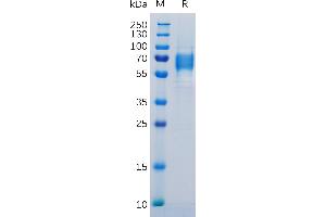 IL-6 Receptor Protein (AA 20-365) (His tag)