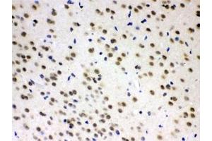 IHC testing of FFPE rat brain with AZIN2 antibody at 1ug/ml. (ADC Antikörper)