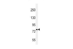 Western blot analysis in NCI-H460 cell line lysates (35ug/lane). (ATRX Antikörper  (C-Term))