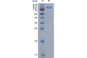 Human Protein, hFc Tag on SDS-PAGE under reducing condition. (NPR1 Protein (AA 33-473) (Fc Tag))