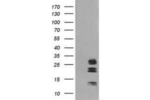 Image no. 1 for anti-Galectin 3 (LGALS3) antibody (ABIN1499247) (Galectin 3 Antikörper)