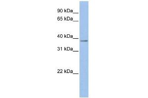 Mesothelin antibody used at 1 ug/ml to detect target protein. (Mesothelin Antikörper  (Middle Region))