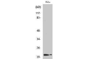 Western Blotting (WB) image for anti-Cyclin-Dependent Kinase Inhibitor 1A (p21, Cip1) (CDKN1A) (pThr145) antibody (ABIN3182099) (p21 Antikörper  (pThr145))