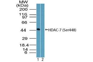 Image no. 1 for anti-Histone Deacetylase 7 (HDAC7) (AA 443-452) antibody (ABIN960196) (HDAC7 Antikörper  (AA 443-452))