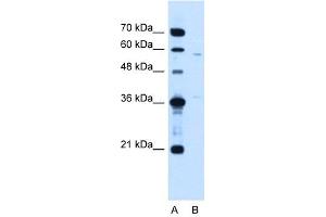 MGC39633 antibody used at 1. (MGC39633 (N-Term) Antikörper)