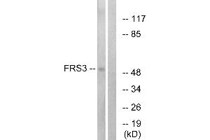 Western blot analysis of extracts from COS-7 cells, using FRS3 antibody. (FRS3 Antikörper)