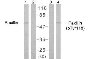 Western blot analysis of the extracts from HeLa cells using Paxillin (Ab-118) antibody (E021107, Lane 1 and 2) and Paxillin (phospho-Tyr118) antibody (E011089, Lane 3 and 4). (Paxillin Antikörper  (pTyr118))