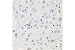 Immunohistochemistry of paraffin-embedded mouse brain using CHCHD3 antibody. (CHCHD3 Antikörper  (AA 1-227))