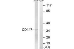 Western blot analysis of extracts from RAW264. (CD147 Antikörper  (AA 336-385))
