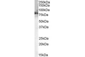 Western Blotting (WB) image for anti-Choline O-Acetyltransferase (CHAT) (AA 629-642) antibody (ABIN299161) (Choline Acetyltransferase Antikörper  (AA 629-642))