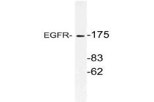 Western blot (WB) analysis of EGFR antibody in extracts from HeLa cells. (EGFR Antikörper)