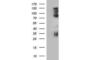 Image no. 1 for anti-CD44 (CD44) antibody (ABIN1497321) (CD44 Antikörper)