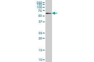 Western Blotting (WB) image for anti-Zinc Finger Protein 496 (ZNF496) (AA 485-586) antibody (ABIN599313) (ZNF496 Antikörper  (AA 485-586))