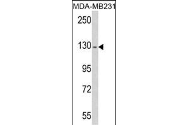 RASGRF1 Antikörper  (AA 907-936)