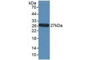 Detection of Recombinant TPT1, Human using Polyclonal Antibody to Tumor Protein, Translationally Controlled 1 (TPT1) (TPT1 Antikörper  (AA 1-172))