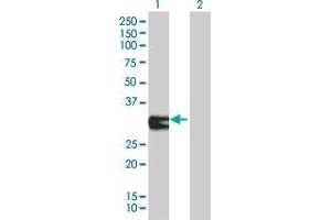 Lane 1: ORC6L transfected lysate ( 27. (ORC6L 293T Cell Transient Overexpression Lysate(Denatured))