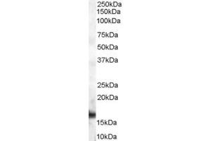 Western Blotting (WB) image for anti-Dachshund 2 (DACH2) (C-Term) antibody (ABIN2156671) (DACH2 Antikörper  (C-Term))