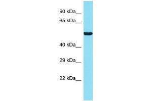 Host: Rabbit Target Name: ANKRD34B Sample Type: 721_B Whole Cell lysates Antibody Dilution: 1. (ANKRD34B Antikörper  (N-Term))