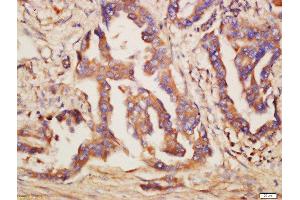 Immunohistochemistry (Paraffin-embedded Sections) (IHC (p)) image for anti-Toll-Like Receptor 6 (TLR6) (AA 301-400) antibody (ABIN749573)