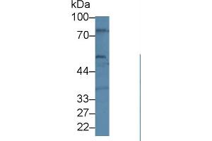 Western blot analysis of Human U87-MG cell lysate, using Human BEST1 Antibody (1 µg/ml) and HRP-conjugated Goat Anti-Rabbit antibody ( (Bestrophin 1 Antikörper  (AA 292-585))