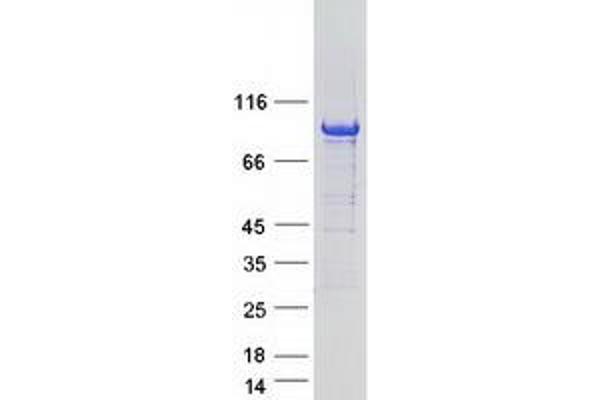 ARHGAP6 Protein (Transcript Variant 4) (Myc-DYKDDDDK Tag)