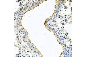 Immunohistochemistry of paraffin-embedded mouse lung using CHCHD3 antibody. (CHCHD3 Antikörper  (AA 1-227))