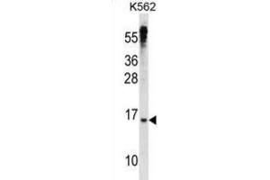 Western Blotting (WB) image for anti-MAX Dimerization Protein 3 (MXD3) antibody (ABIN2998538) (MXD3 Antikörper)