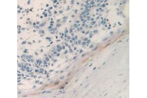 IHC-P analysis of Human Tissue, with DAB staining. (PSCA Antikörper  (AA 22-95))