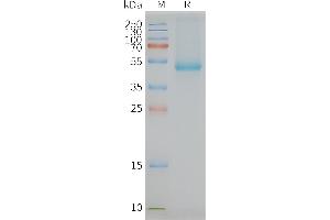 SLC7A11 Protein